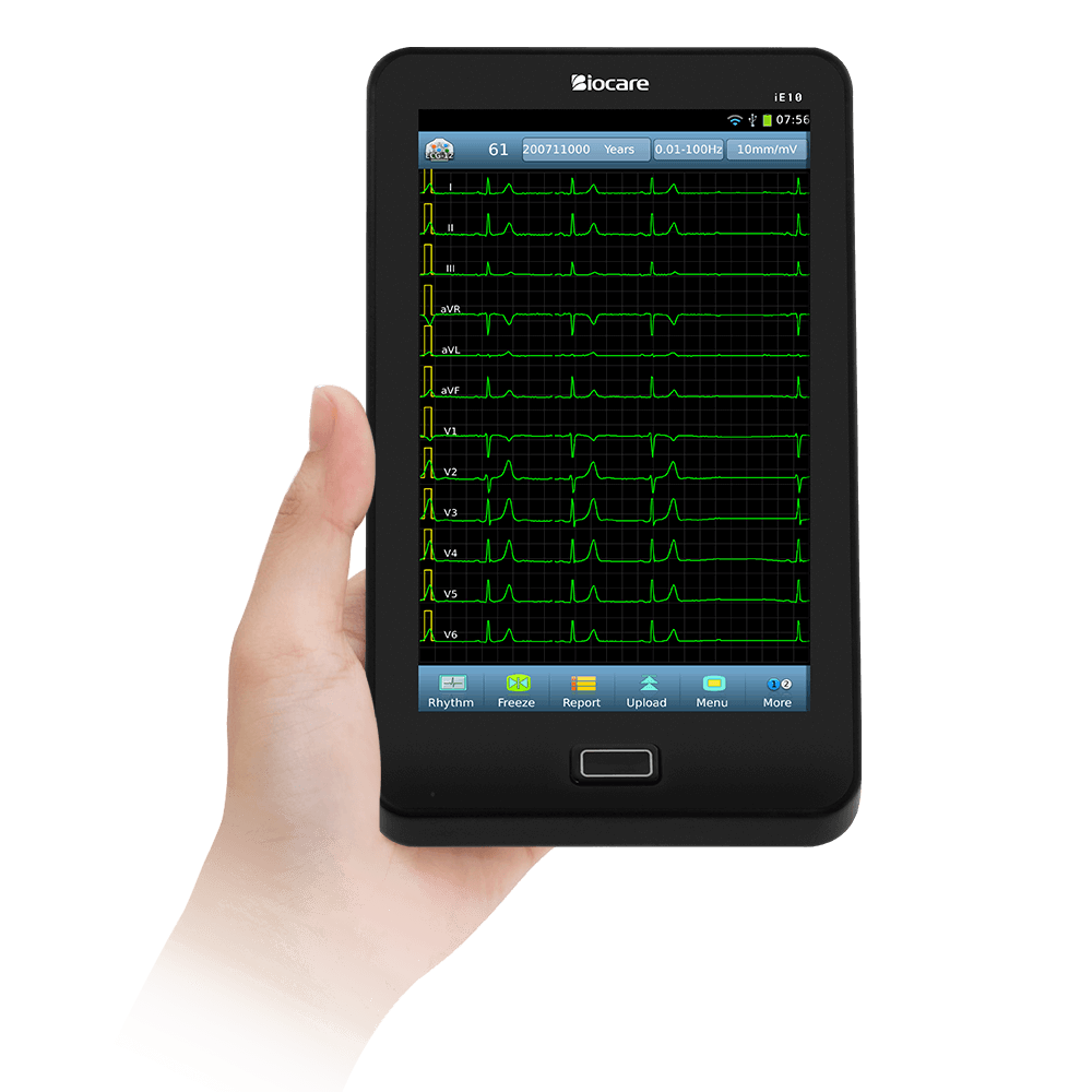 PointofCare 12Lead ECG/EKG Machine Based on A Tablet, with Auto